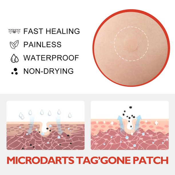 MicroDarts TAG’Gone Patch