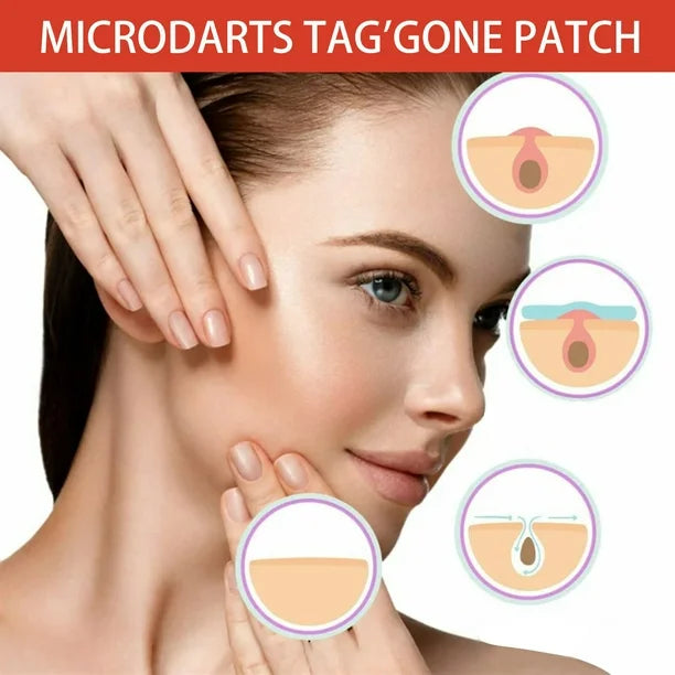 MicroDarts TAG’Gone Patch